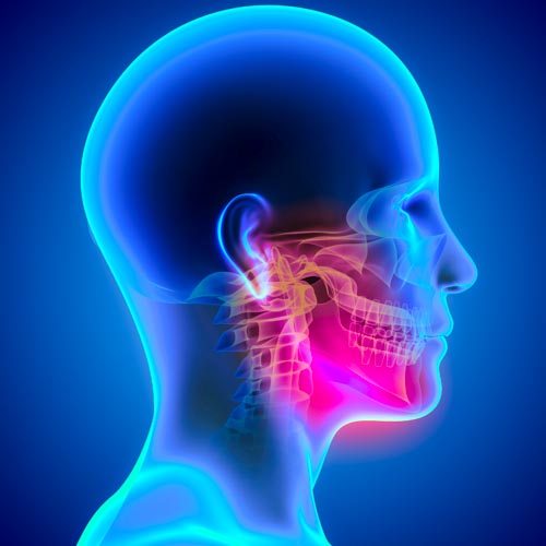 Orofacial Pain0